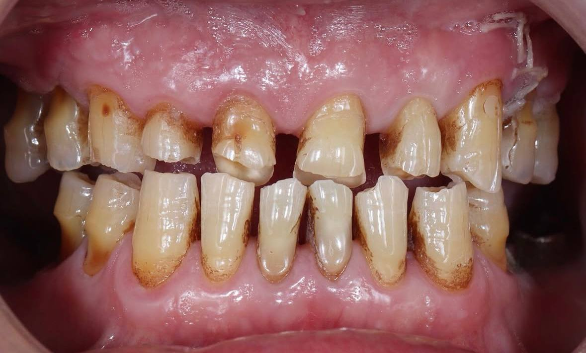 Стан шкіри до процедури №3